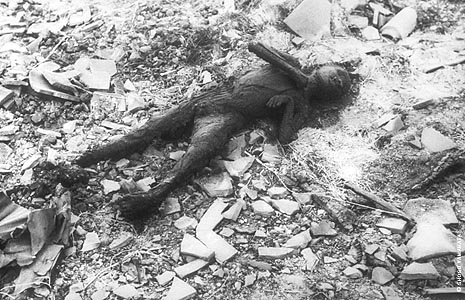 Ein von einer Atombombe verbranntes Kind: